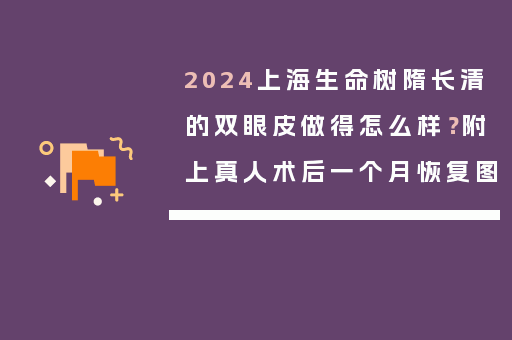 2024上海生命树隋长清的双眼皮做得怎么样？附上真人术后一个月恢复图